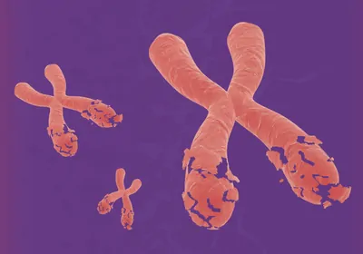 Conceptual image showing fragmented X chromosomes